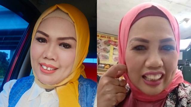 Beda Gaya Ely Sugigi Sebelum Vs Sesudah Potong Gigi (sumber: instagram/ellysugigi_real_)