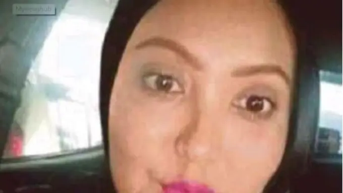 [Bintang] Ketagihan Suntik Kolagen, Hal Mengerikan Terjadi Pada Wanita Ini