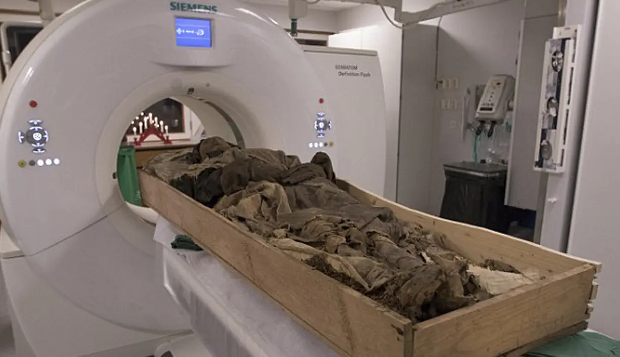 Peneliti melakukan CT scan menggunakan X-ray untuk mempelajari mumi Uskup Winstrup yang menjadi pemimpin gereja paling berpengaruh di Eropa. (Dailymail.co.uk) 