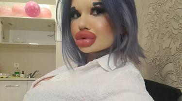 Ingin Tampil Bak Boneka, Wanita Akan Injeksi Bibir Ke 27 Kali Akhir Tahun Ini