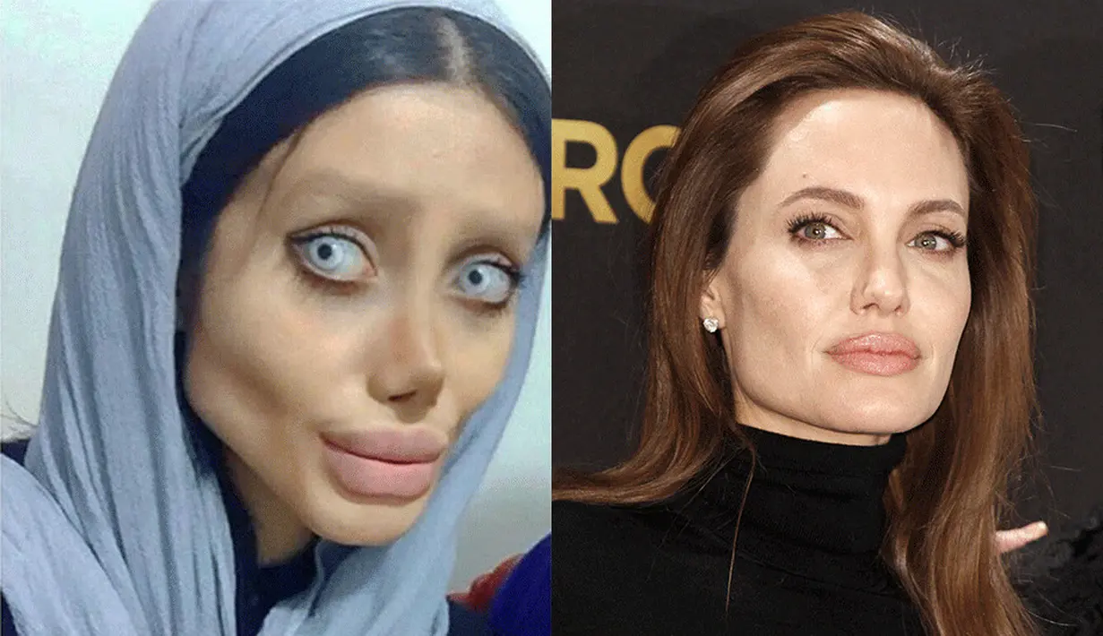 Sahar Tabar adalah gadis Iran yang rela menjalani 50 kali operasi agar wajahnya mirip dengan sang idola Angelina Jolie. (cloudmind.info)