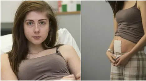 Setiap Kali Makan Perutku Akan Buncit Seperti Ibu Hamil Beauty Fimela Com