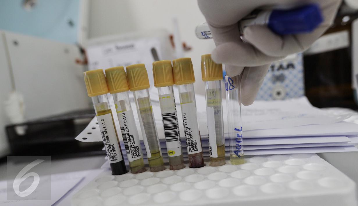 Sejumlah tabung bertuliskan nama pasien siap dimasukan ke dalam mesin pemutaran darah laboratorium kesehatan, Rumah Sakit Husada, Jakarta, Rabu (08/2). (Fery Pradolo/Liputan6.com)