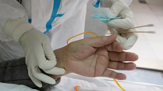 Keunggulan Akupunktur Laser dari Terapi Jarum, Salah Satunya Tak Timbulkan Rasa Sakit Berlebih