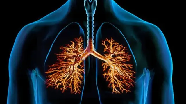 Ilustrasi. (foto: Pinterest/WebMD).