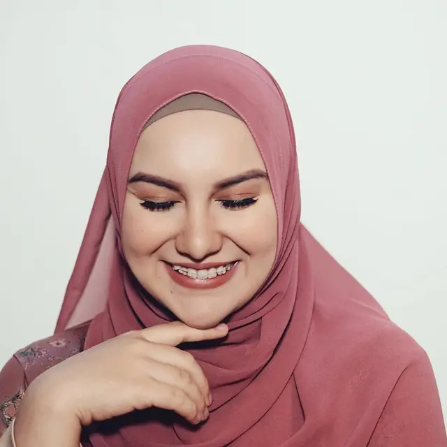 6 Potret Terbaru Irish Bella Tampil Pakai Behel, Ingin Hilangkan Gingsul