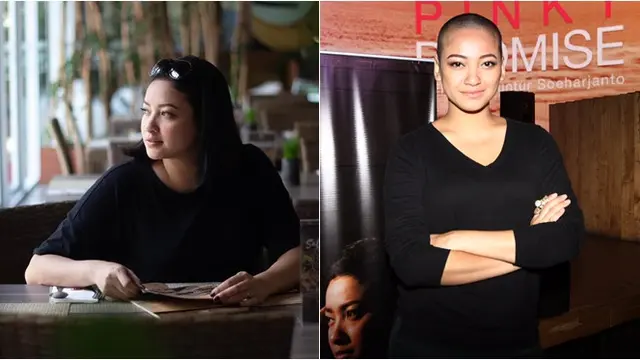 Demi Peran, 5 Artis Cantik Ini Rela Tampil Botak