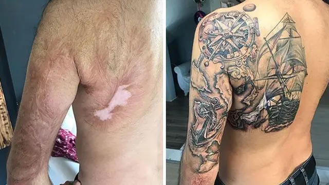 Gunakan Tato Untuk Menutupi Bekas Luka, 6 Potret Hasilnya Bikin Takjub. (Sumber: Boredpanda)