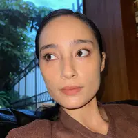 Unggah Foto Wajah Penuh Jerawat, Tatjana Saphira Dipuji Tetap Cantik. (Foto: instagram.com/tatjanasaphira)